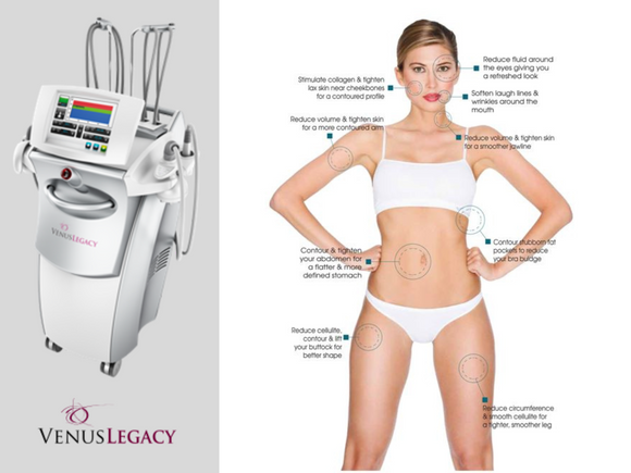 VENUS LEGACY RF SKIN TIGHTENING - 8 Sessions