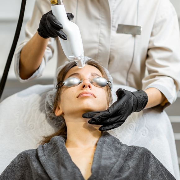 Laser Resurfacing- FACE & NECK