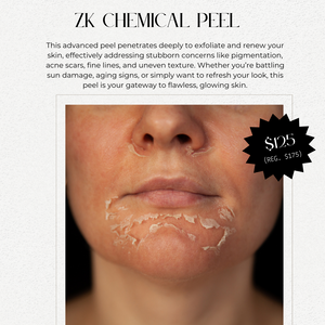 ZK CHEMICAL PEEL